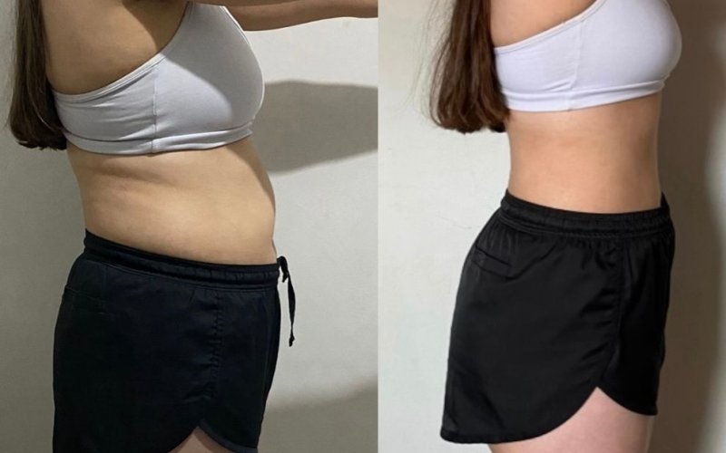 Bölgesel İncelme Gerçekten İşe Yarıyor mu? Diyet ve Spora Rağmen Gitmeyen Yağların Sebebi Nedir?