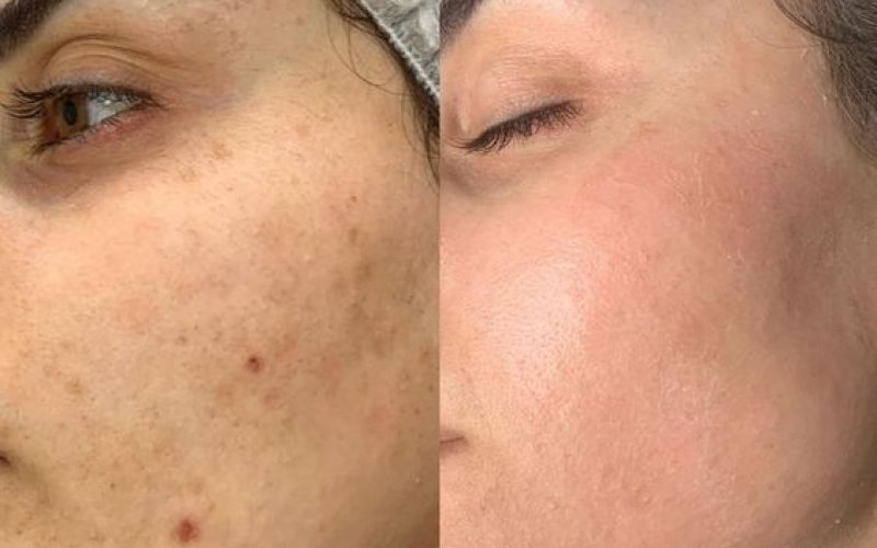 Cilt Sorunları İçin Profesyonel Çözümler